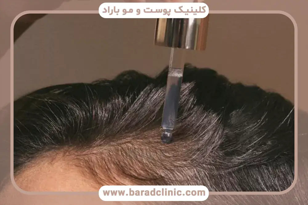 هزینه مایکروپوینت