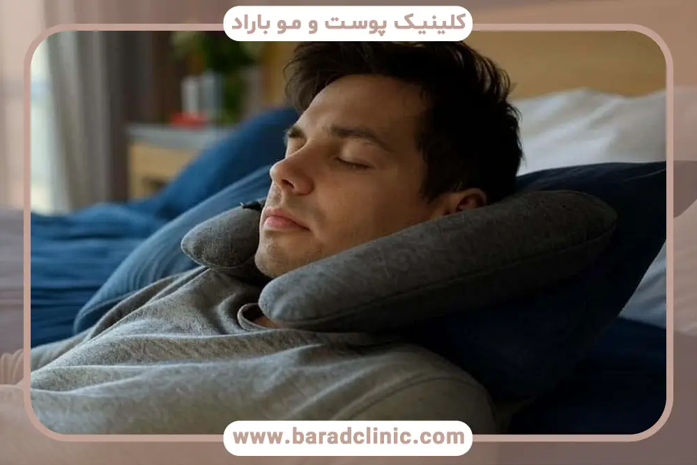 خوابیدن بعد از کاشت ریش