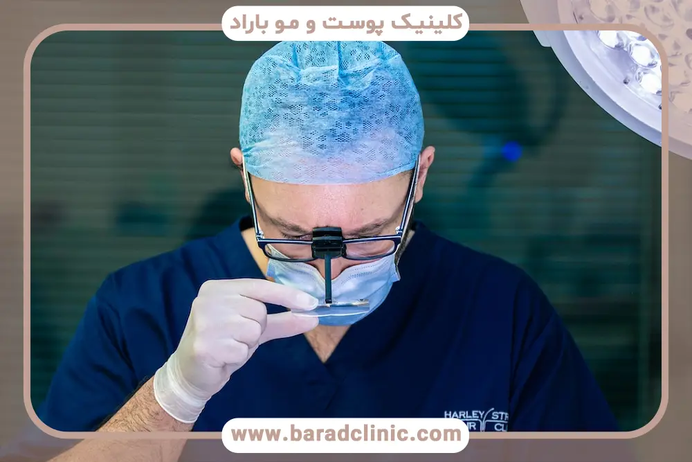 کاشت مو چند ساعت طول میکشد