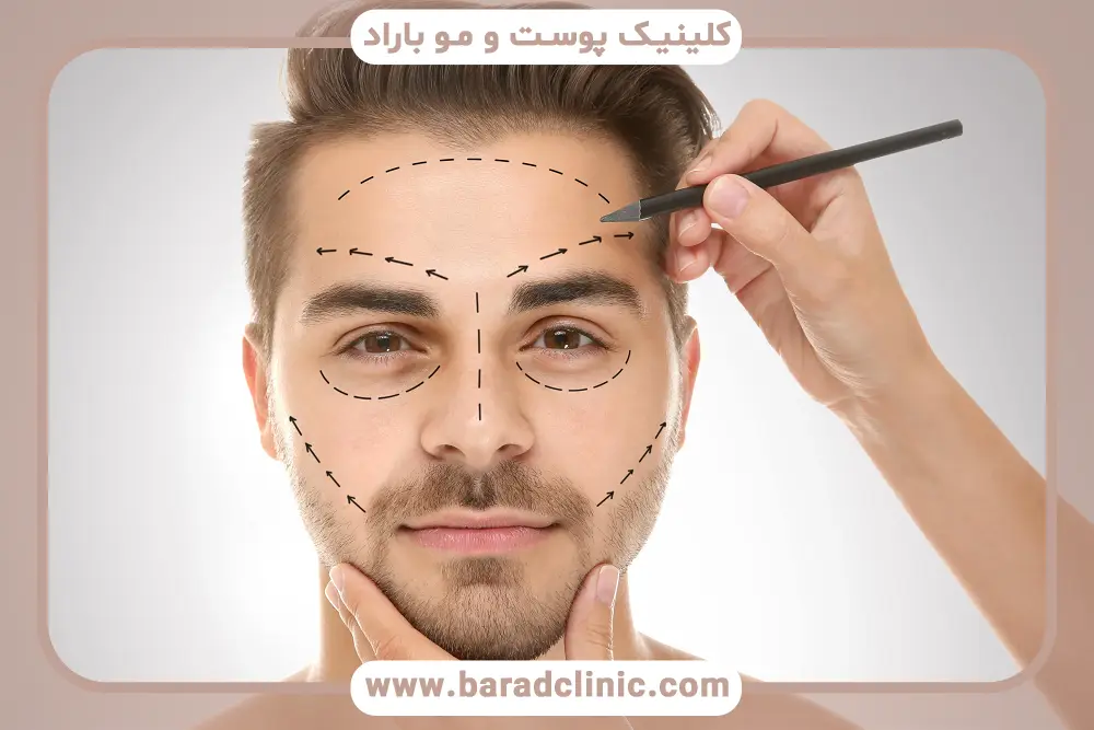 عمل پروسیجر چیست