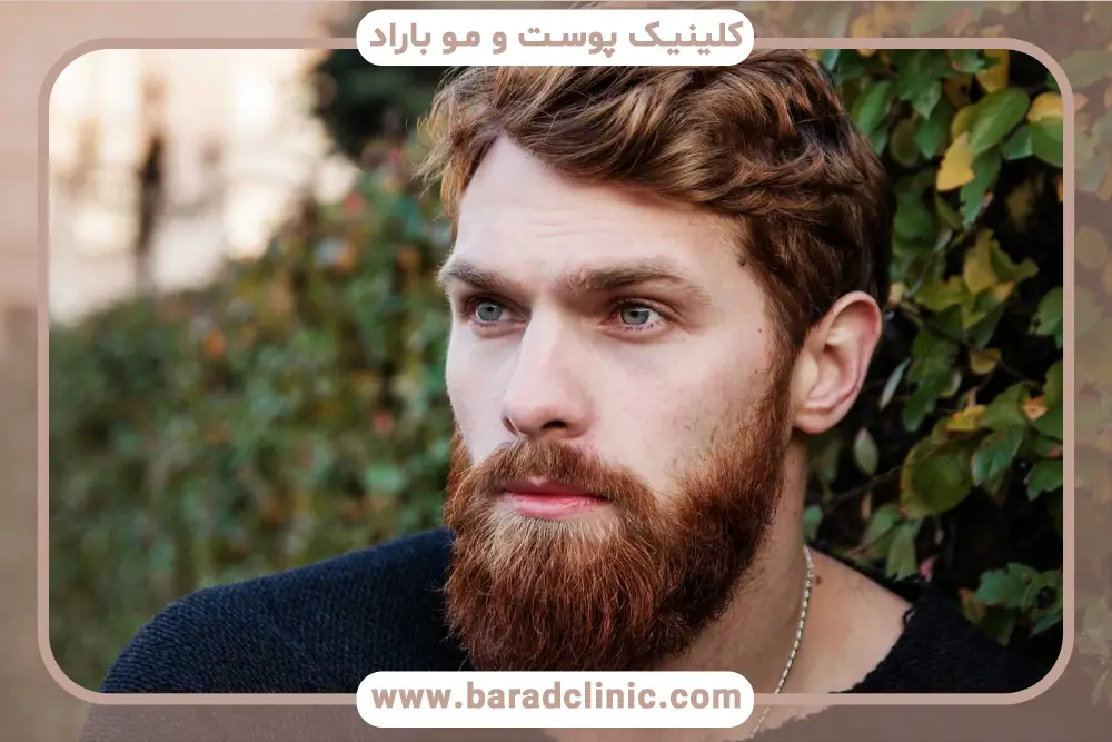 جدیدترین روش کاشت ریش