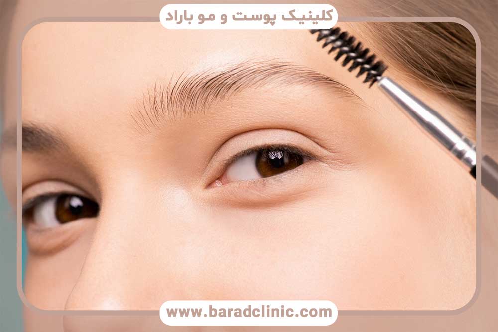 دوام کاشت ابرو