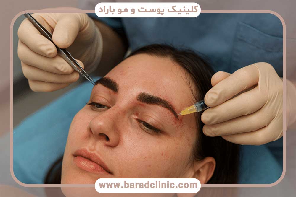 خطرات کاشت ابرو