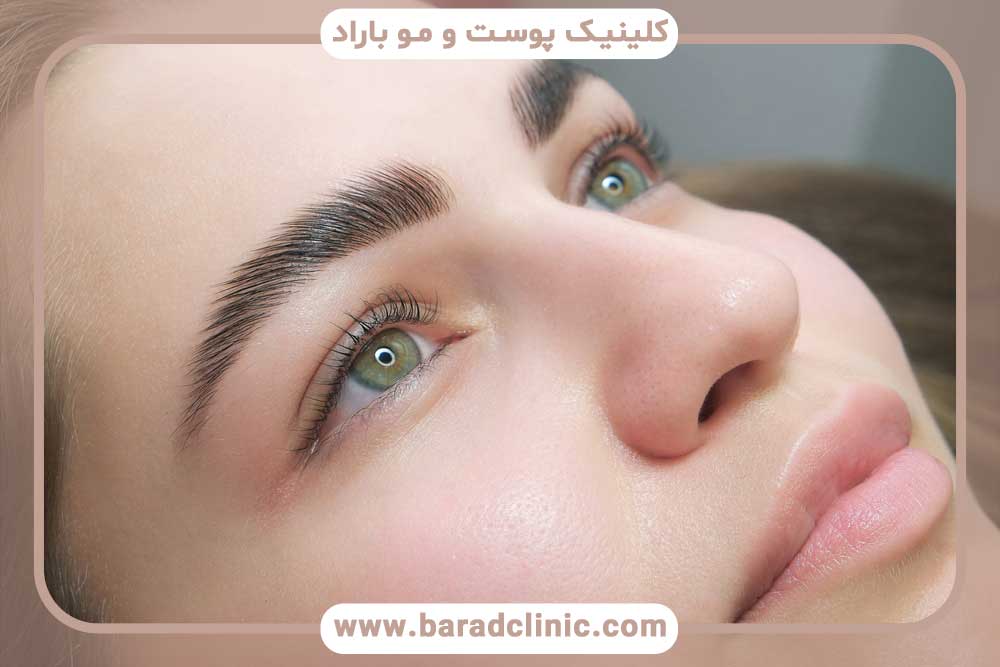 دوام کاشت ابرو