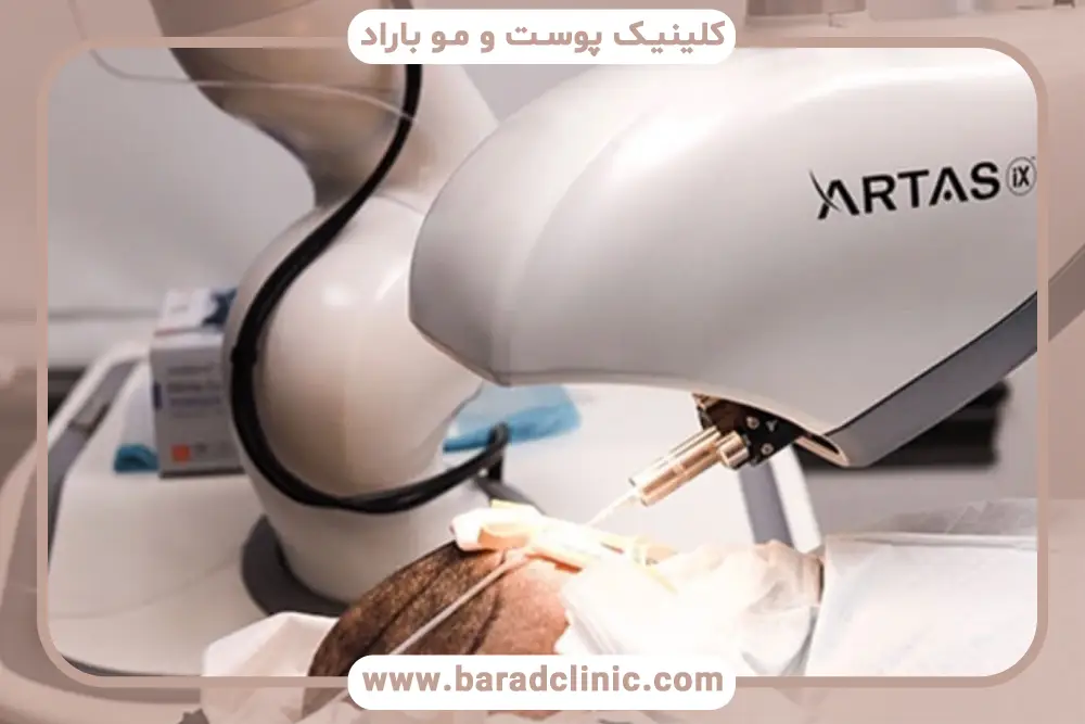 تفاوتهای کلیدی بین کاشت مو با دستگاه و دستی