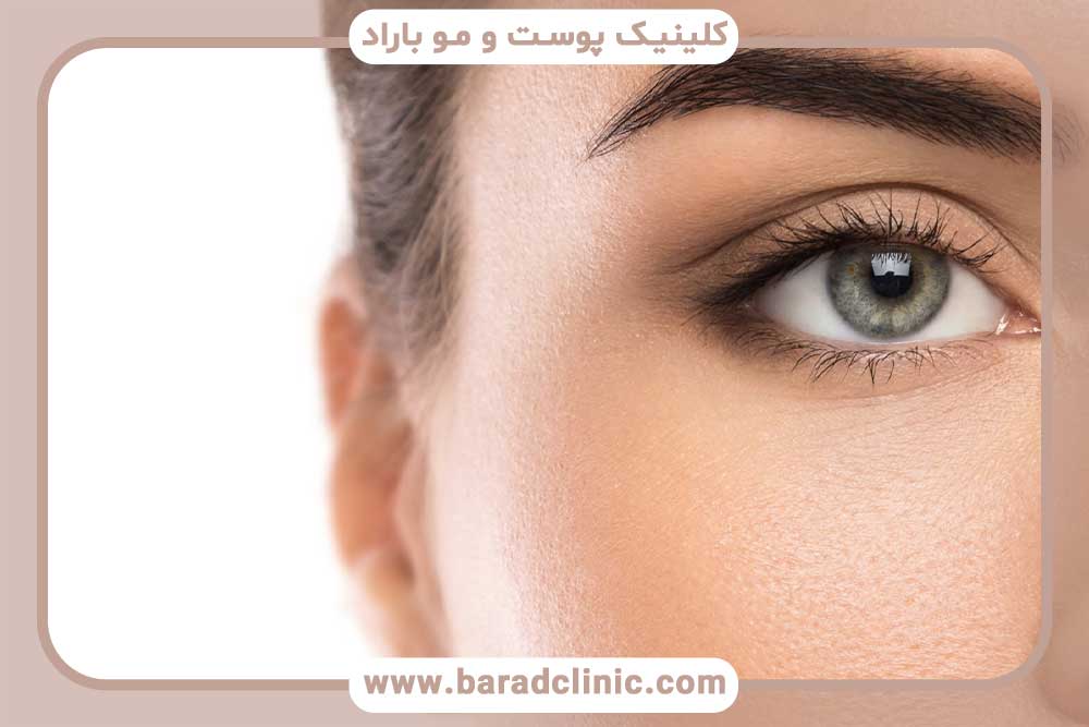 کاشت ابرو برای صورت گرد