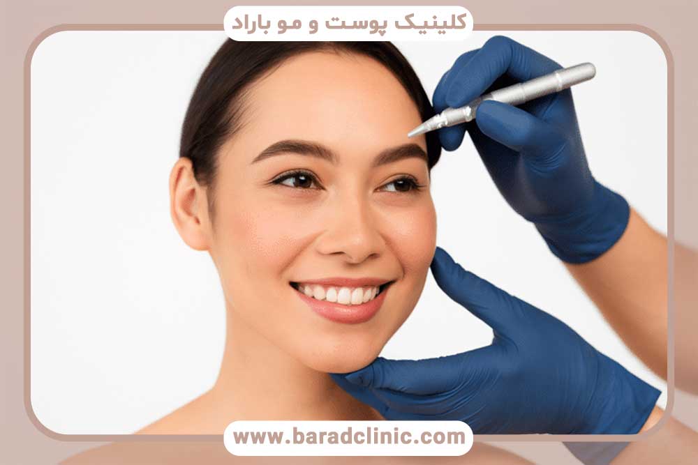 کاشت ابرو گربه ای