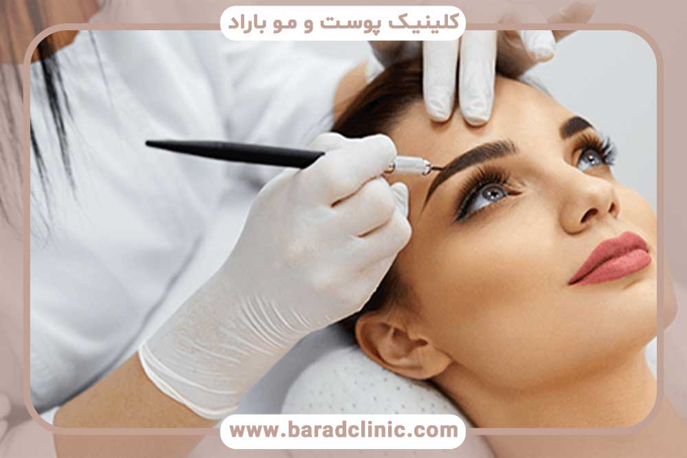 کاشت ابرو روی تاتو