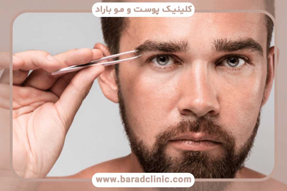 بهترین کاشت ابرو تهران