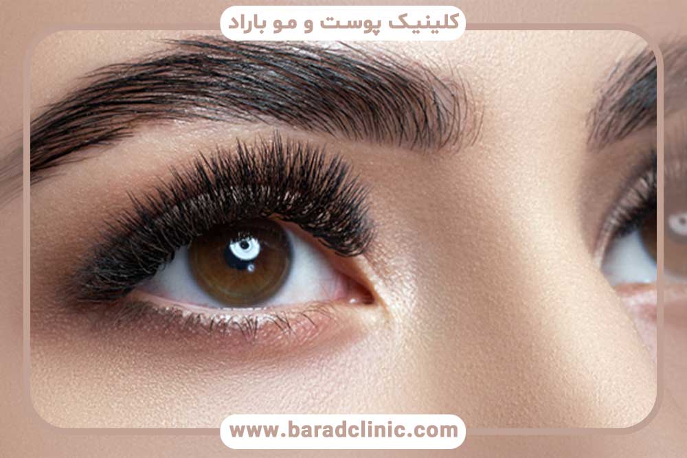 راکوتان و کاشت ابرو