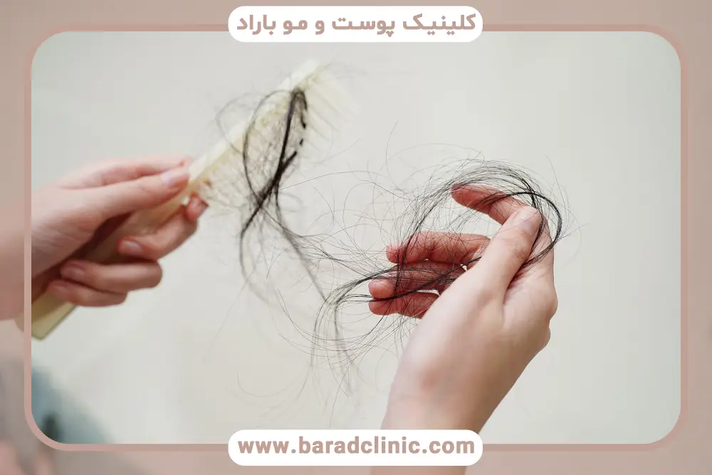 آشنایی با تنبلی تخمدان