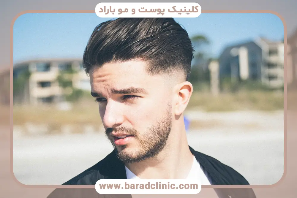 مراحل روش fit کاشت مو