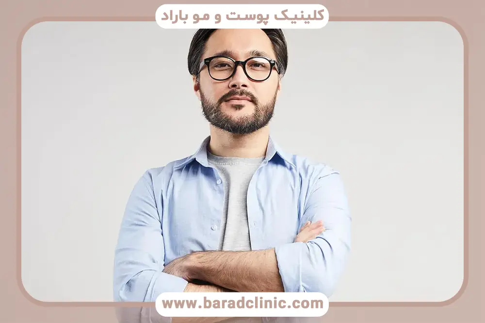کاشت ریش نظرات واقعی
