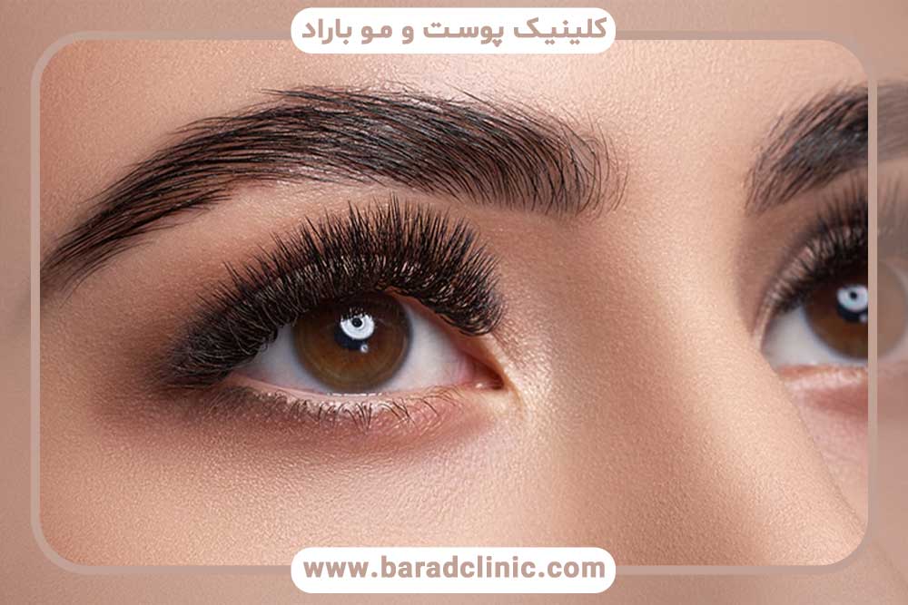 جای بخیه بعد از کاشت ابرو