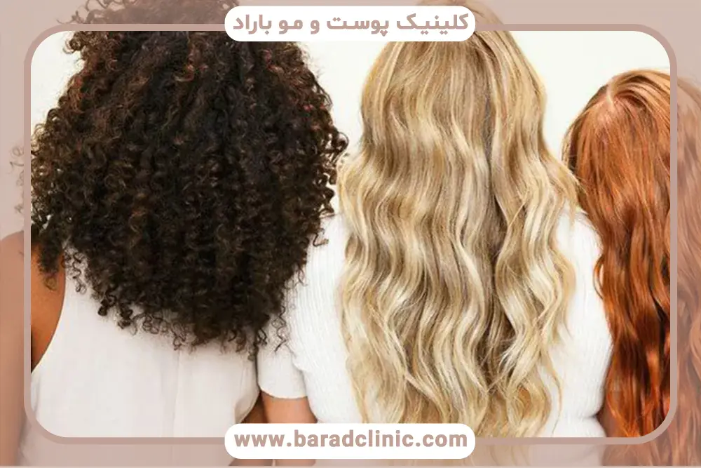 عوامل موثر بر هزینه مایکروپوینت 