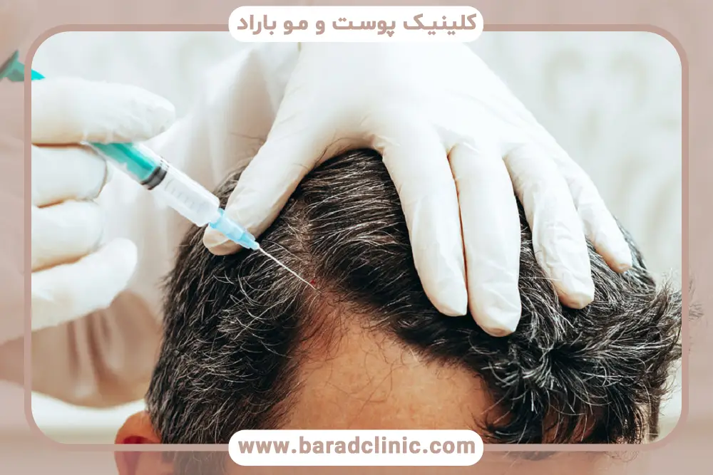 معیارهای اصلی انتخاب بهترین کلینیک کاشت مو تهران