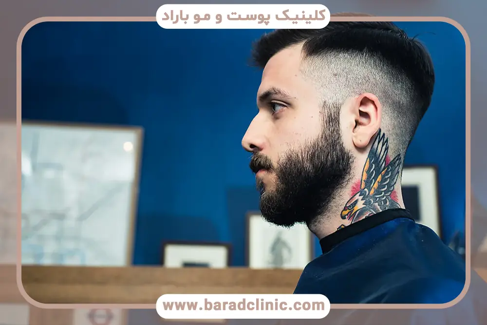 دلایل اهمیت خط کاشت ریش