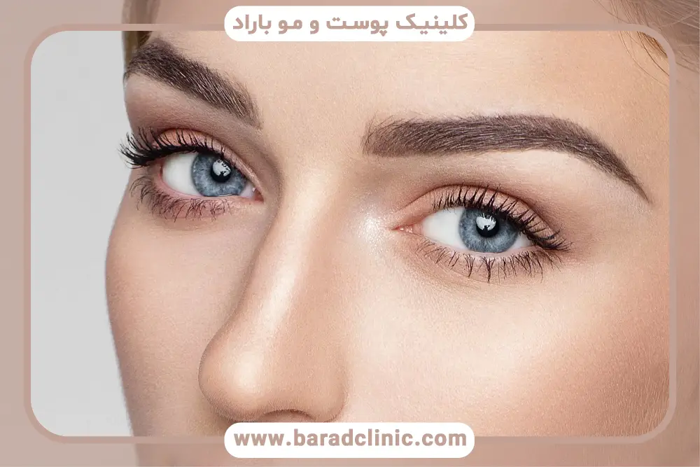 دلایل خارش بعد از کاشت ریش