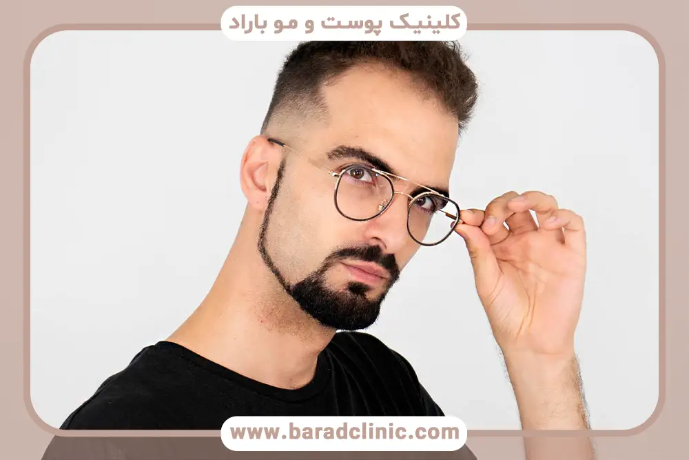 مزایای کاشت ریش چانه