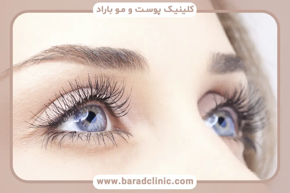 روش‌های غیرجراحی جایگزین بلفاروپلاستی