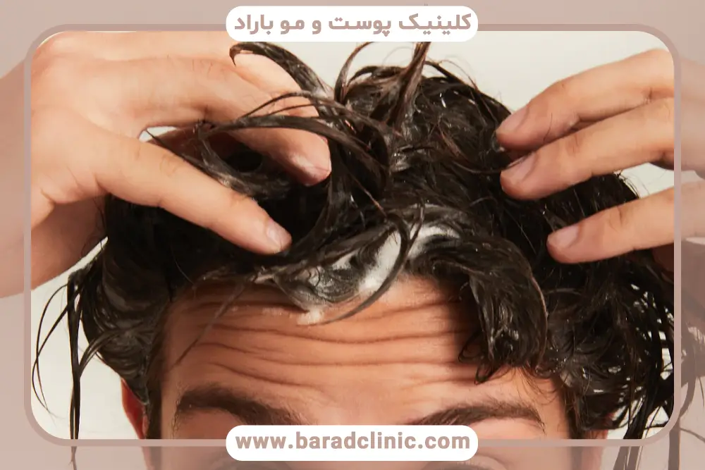 دلایل اصلی خارش سر بعد از کاشت مو