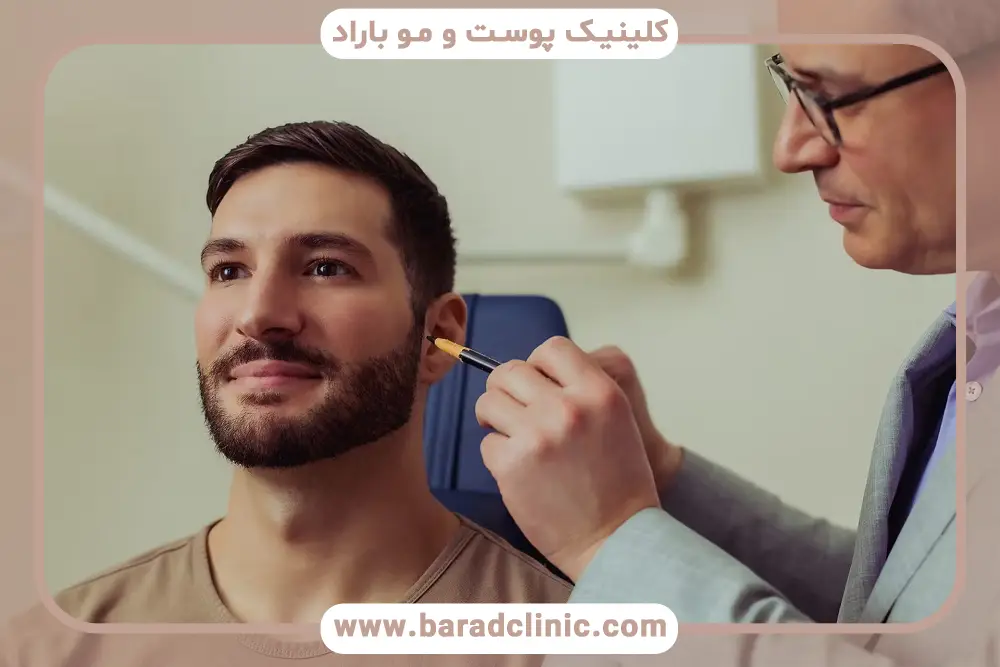 مزایای کاشت تخصصی ریش