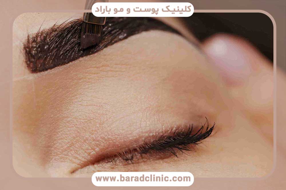 رنگ ابرو بعد از کاشت