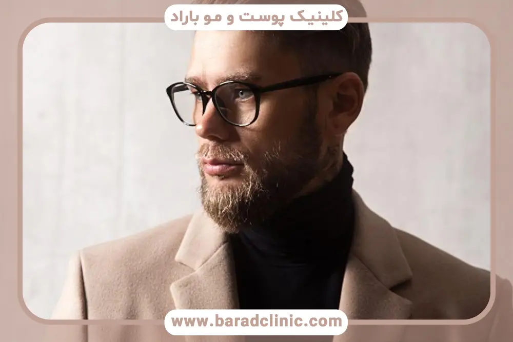 آشنایی با کاشت ریش جای سوختگی