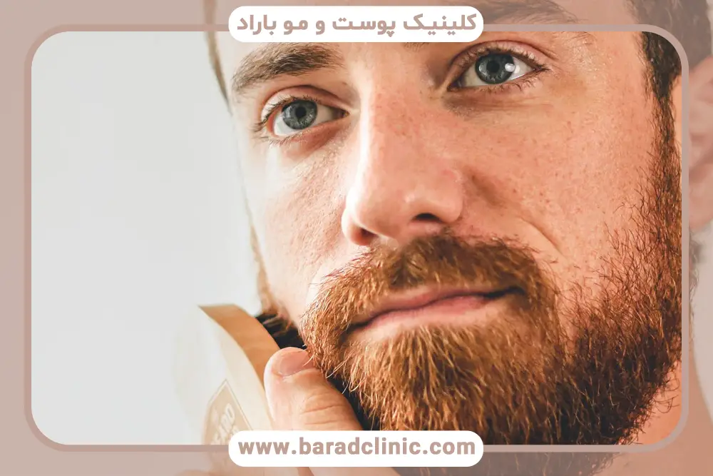 مراحل و تکنیکهای کاشت ریش مردانه
