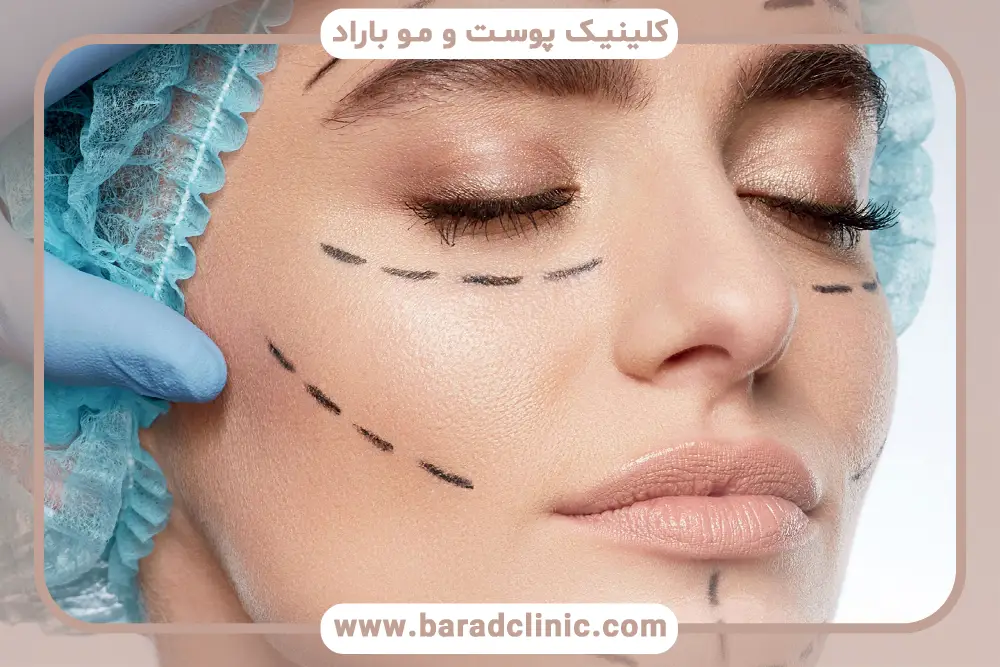 عمل پروسیجر چیست؟ تعریف کلی