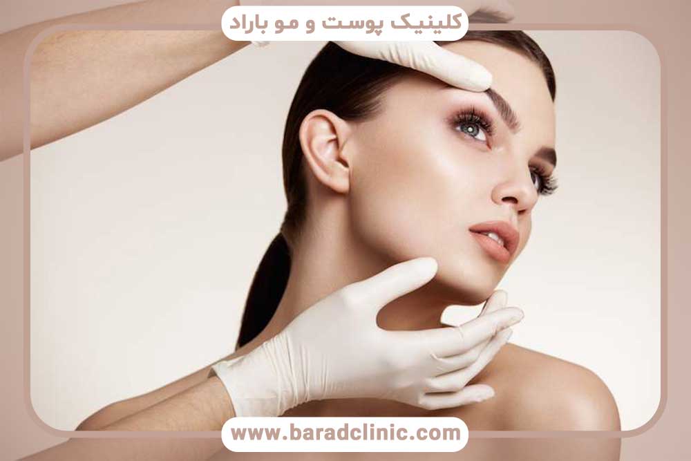 کاشت ابرو گربه ای