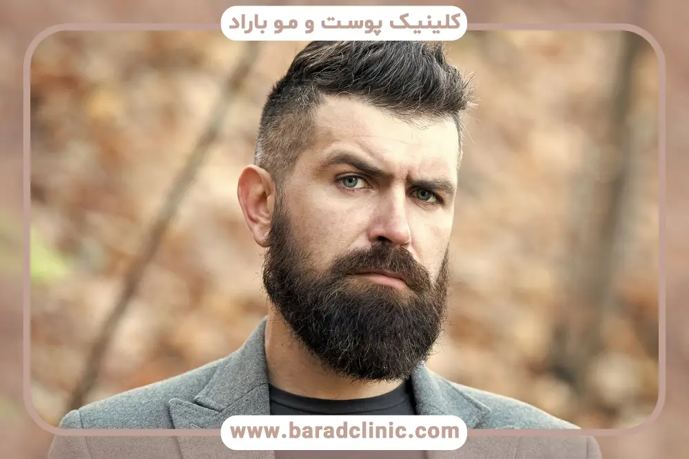تفاوت کاشت ریش در خانه  و کاشت ریش حرفه‌ای
