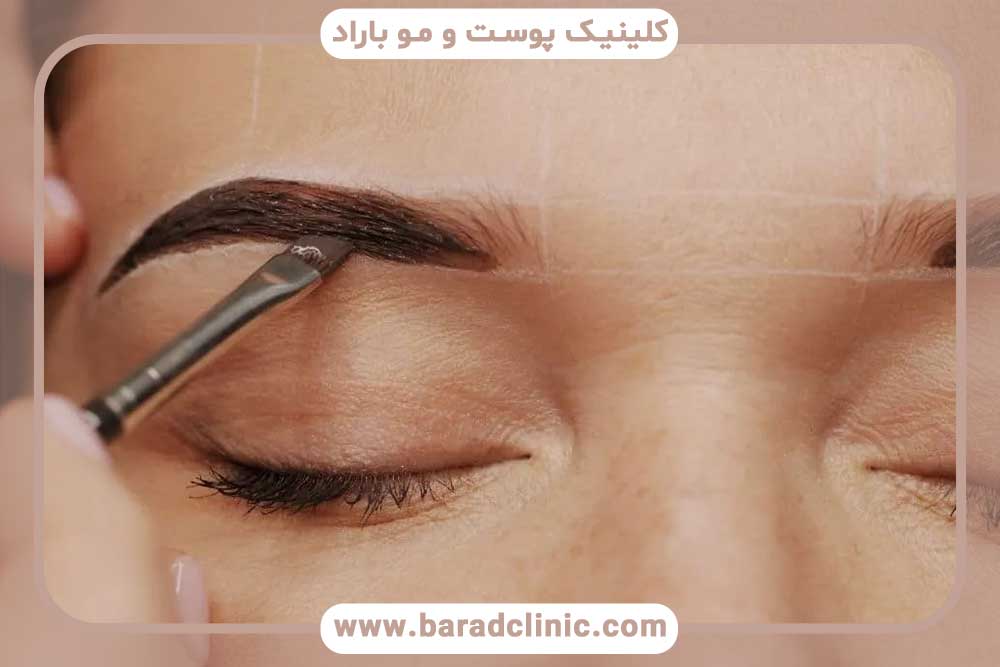 کاشت ابرو روی تاتو