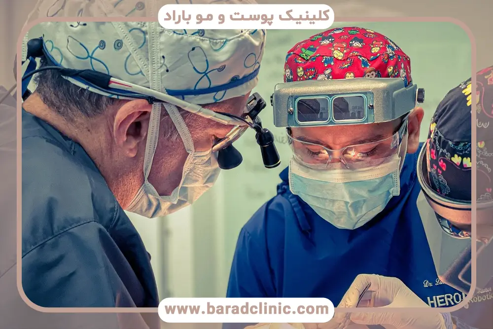 شرایط کاشت ریش روی سر 