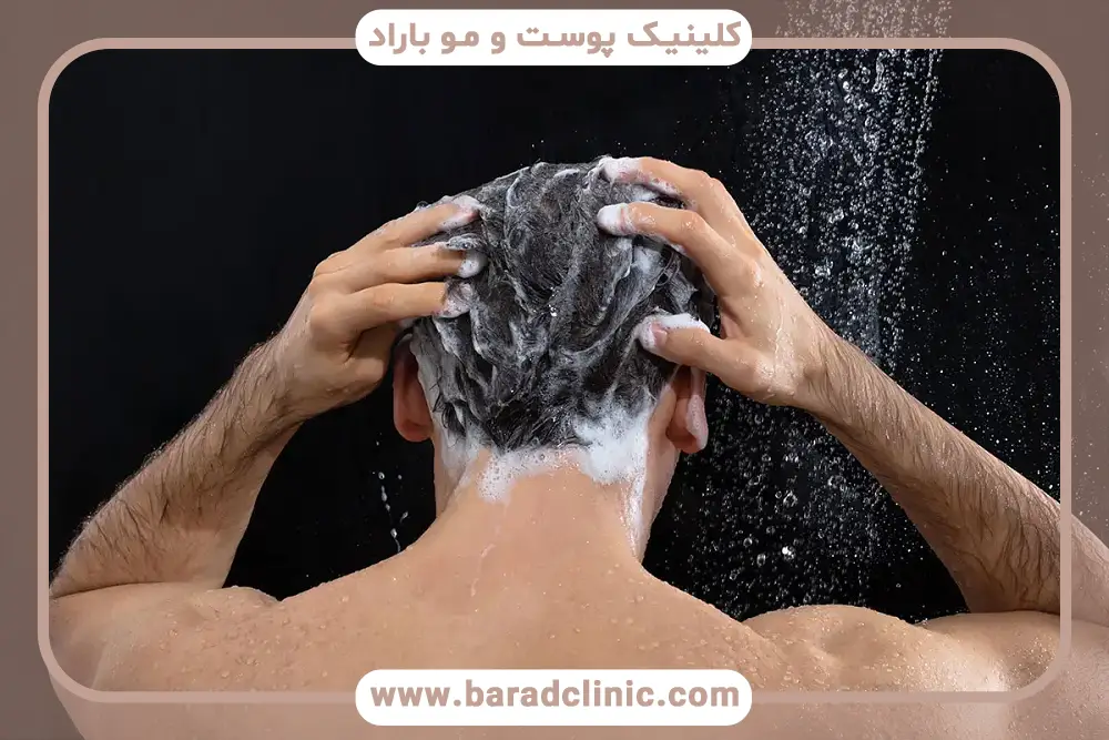 بهترین شامپو بعد از کاشت مو و انواع آن