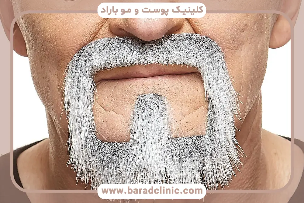 روش‌های کاشت ریش سفید