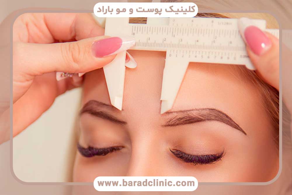 کاشت ابرو بدون برش سر