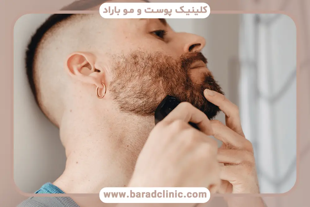تفاوت خط کاشت ریش مصنوعی و طبیعی