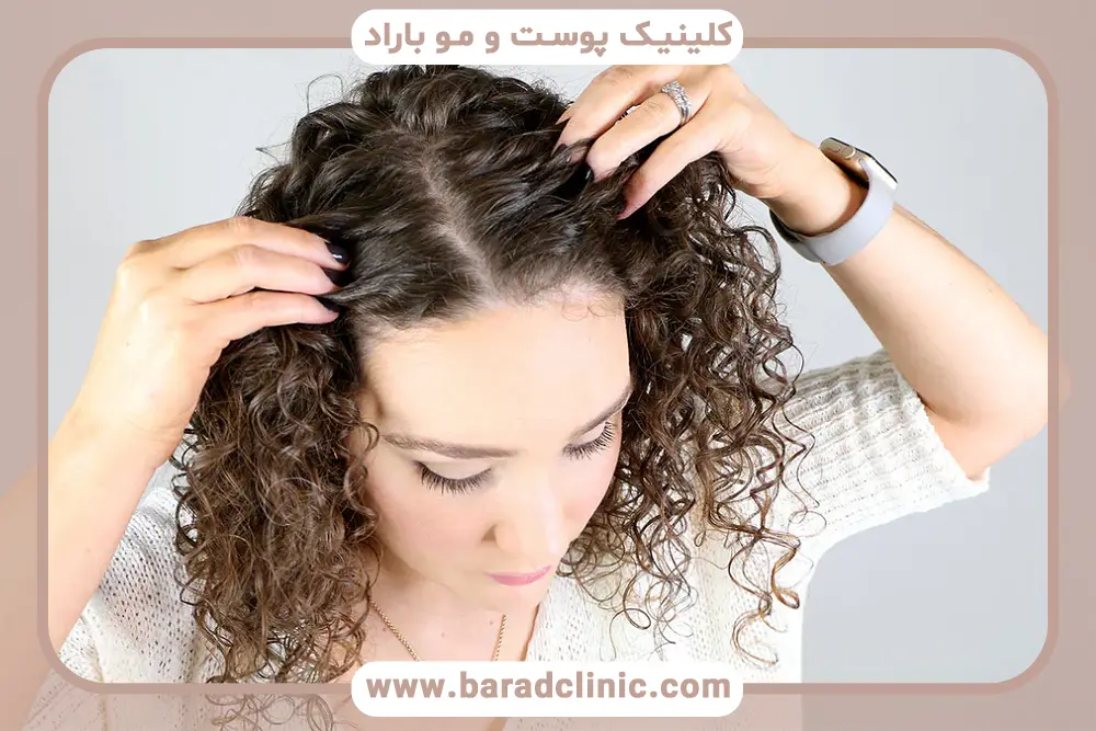 تاثیر خشکی پوست روی خارش سر بعد از کاشت مو