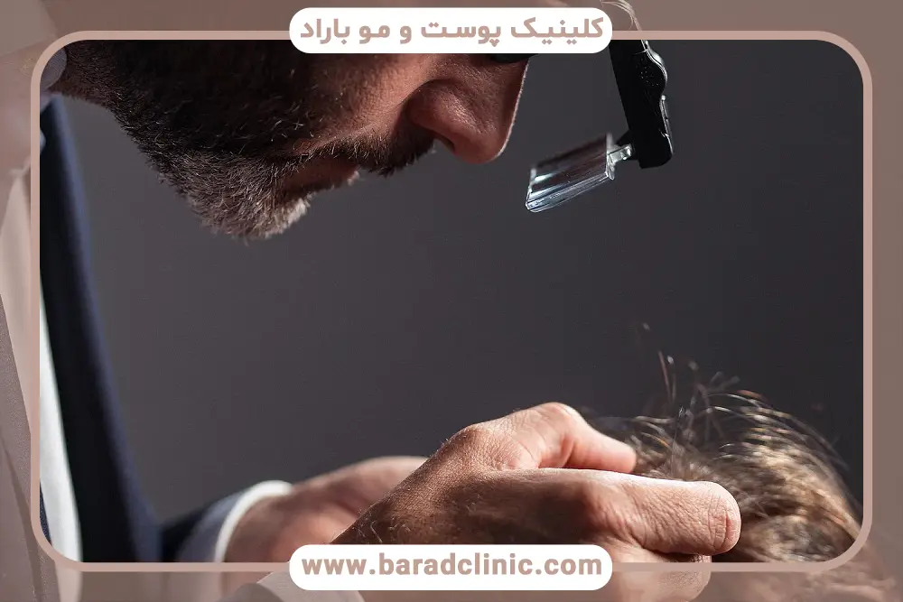 بررسی جزئیات فیلم ترمیم مو به روش مایکروپوینت 