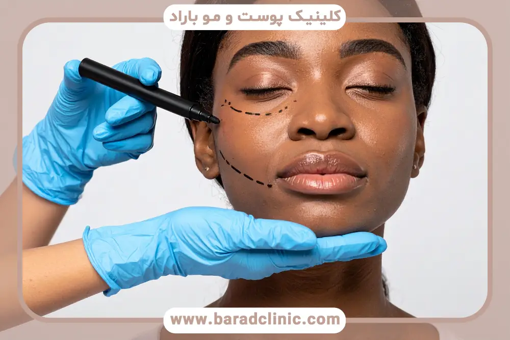 کاربردهای عمل پروسیجر چیست؟