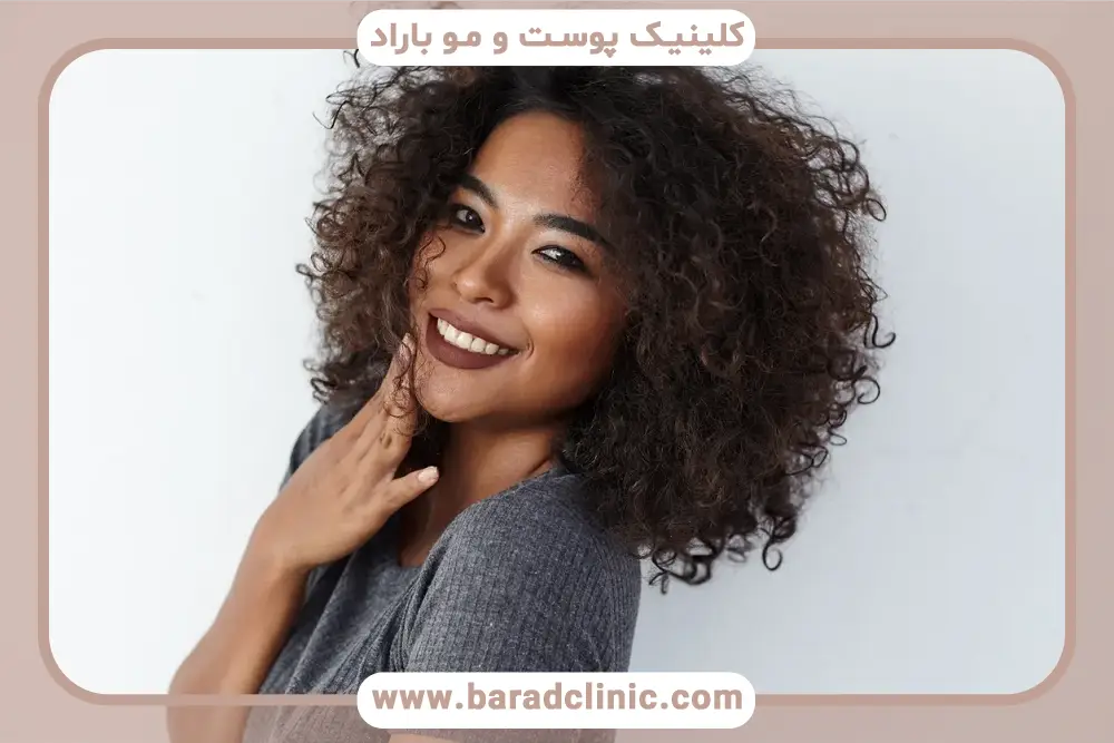 معایب و محدودیت‌های مایکروپوینت موی سر 