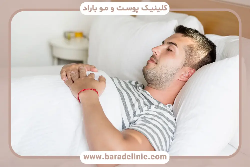 اشتباهات رایج در نحوه خواب بعد از کاشت مو 