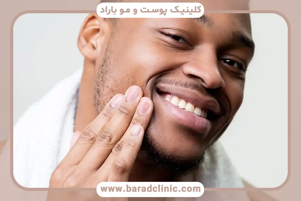 هزینه و زمان کاشت ریش کم پشت