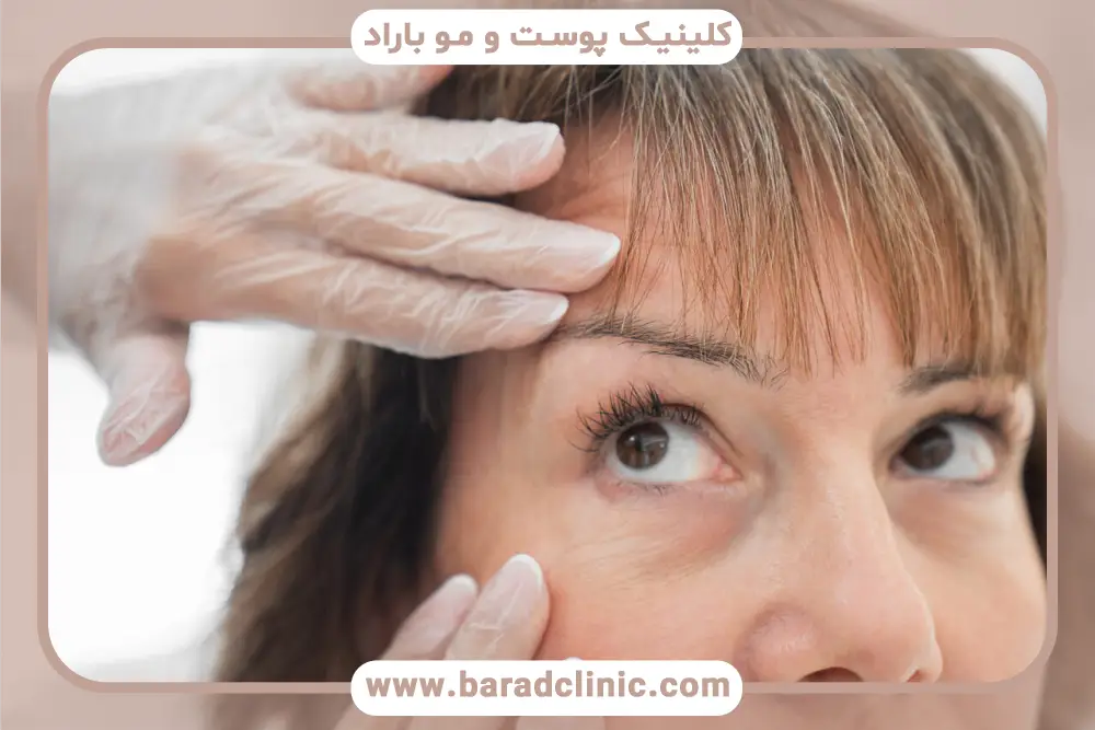 بهترین جراح بلفاروپلاستی