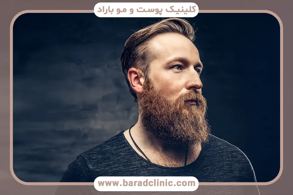 کاشت ریش نظرات درباره رویش طبیعی
