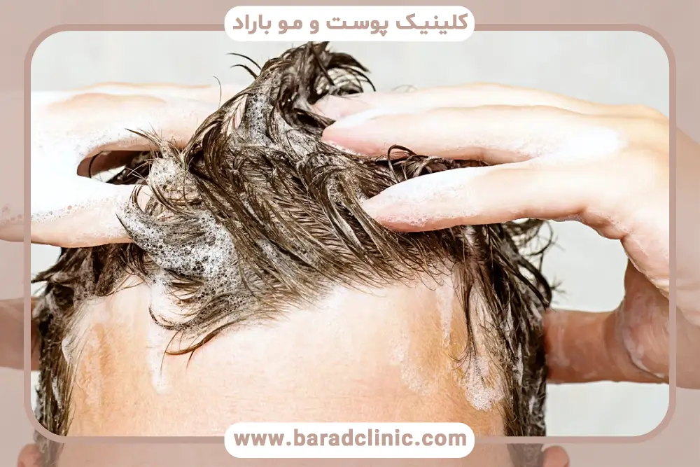 ترکیبات بهترین شامپو بعد از کاشت مو