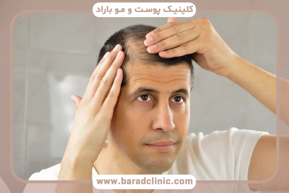 پرداخت هزینه مایکروپوینت با بیمه