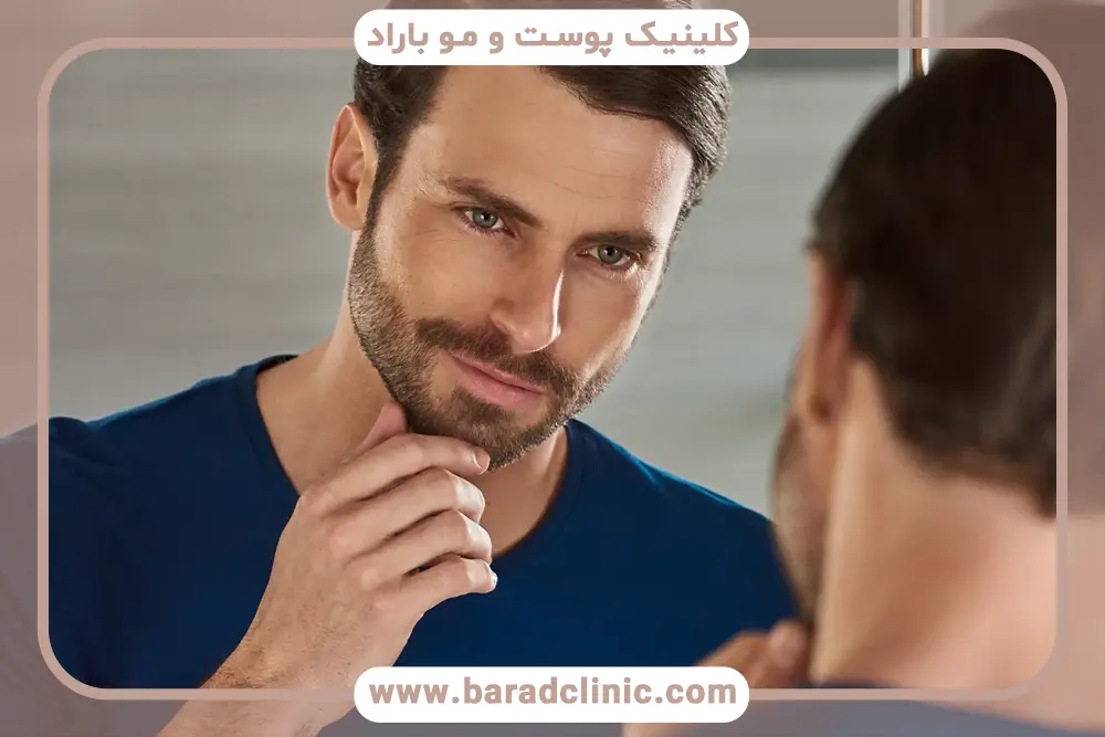 مراقبت‌های بعد از پیوند خط کاشت ریش