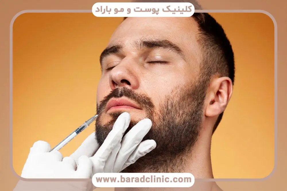 کاندیدای مناسب کاشت ریش وی ای پی 